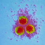 herpes-zoster-virus-contagious-i3