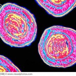 Coloured TEM of Bordetella pertussis bacteria