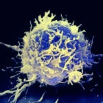epilessia 1