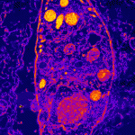 toxoplasma_gondii_micro