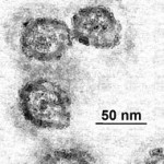 190px-Em_flavavirus-HCV_samp1c