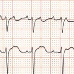 ECG9B-st-21-1024x310