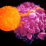 cellula_cancro_linfoma