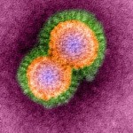 influenza-aviaria-allarme-pandemia