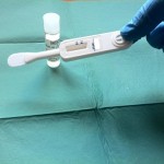 dispositivo-test-rapido-HIV (1)