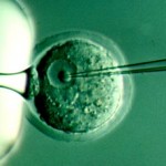 microinyeccion