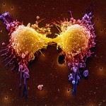 cellule-tumorali-tumore