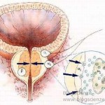 prostata