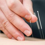 agopuntura-e-riabilitazione
