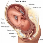 trapianto_utero_scezia_blog_timeoutintensiva