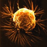 cancer_cell