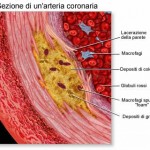 malattie cardiache colesterolo cibi non sani