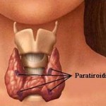 paratiroidi