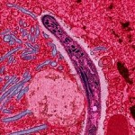 220px-Malaria