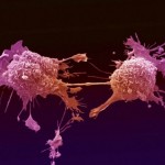 Cancro-infezioni