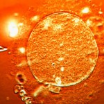 DIAGNOSI-PREIMPIANTO