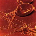 globulo rosso e fibrina