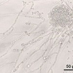 220px-Candida_albicans