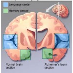 understanding-alzheimers-disease-basics-Memory_and_Language_Centers