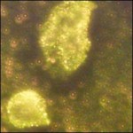 gold-nanoparticelle