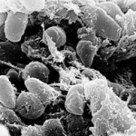 270px-Yersinia_pestis