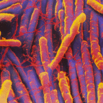 Clostridium-difficile_456px