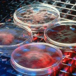 cellule-staminali-del-cordone-ombelicale-per-curare-intestino1