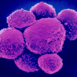 nkcell2