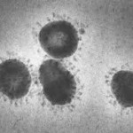 395799_coronavirus-sars