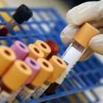 leggere-analisi-del-sangue