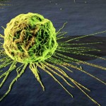 247866_cancro tumore 021