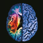 Ictus.-La-molecola-salvacervello_h_partb