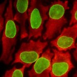 1364397620324_coloriproteine