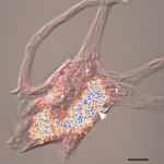 Lipofuscin_neuro