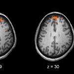 Schizophrenia_fMRI_working_memory