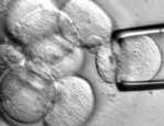 Malattie autoimmuni_5673
