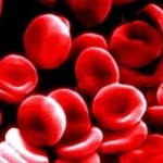 anemia (1)