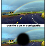 degenerazione_maculare_senile