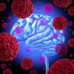 11995657-cancro-al-cervello-umano-con-le-cellule-e-la-crescente-diffusione-di-cellule-maligne-in-un-essere-um