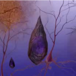 Alzheimers_neurons-tangles-bundles
