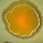 Mycobacterium_balnei_(CDC-PHIL_-3111)_lores