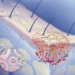 psoriasi_flickr