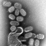 EM_of_influenza_virus