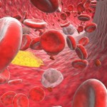 colesterolo-alto-come-combatterlo-con-rimedi-naturali_ce2acc946d470d50f78dbb22a3ba6b6c
