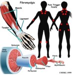 fibromialgia-farmaco1