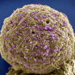 image_1326-HIV-genistein