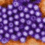 image_1376-Norovirus