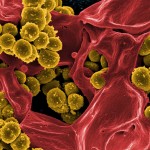 image_1548e-MRSA