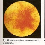 oftalmologia_y_sus_anexos_20110727_1958526031