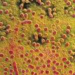 Epatite-B-virus_gallery